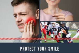 mouthguards image