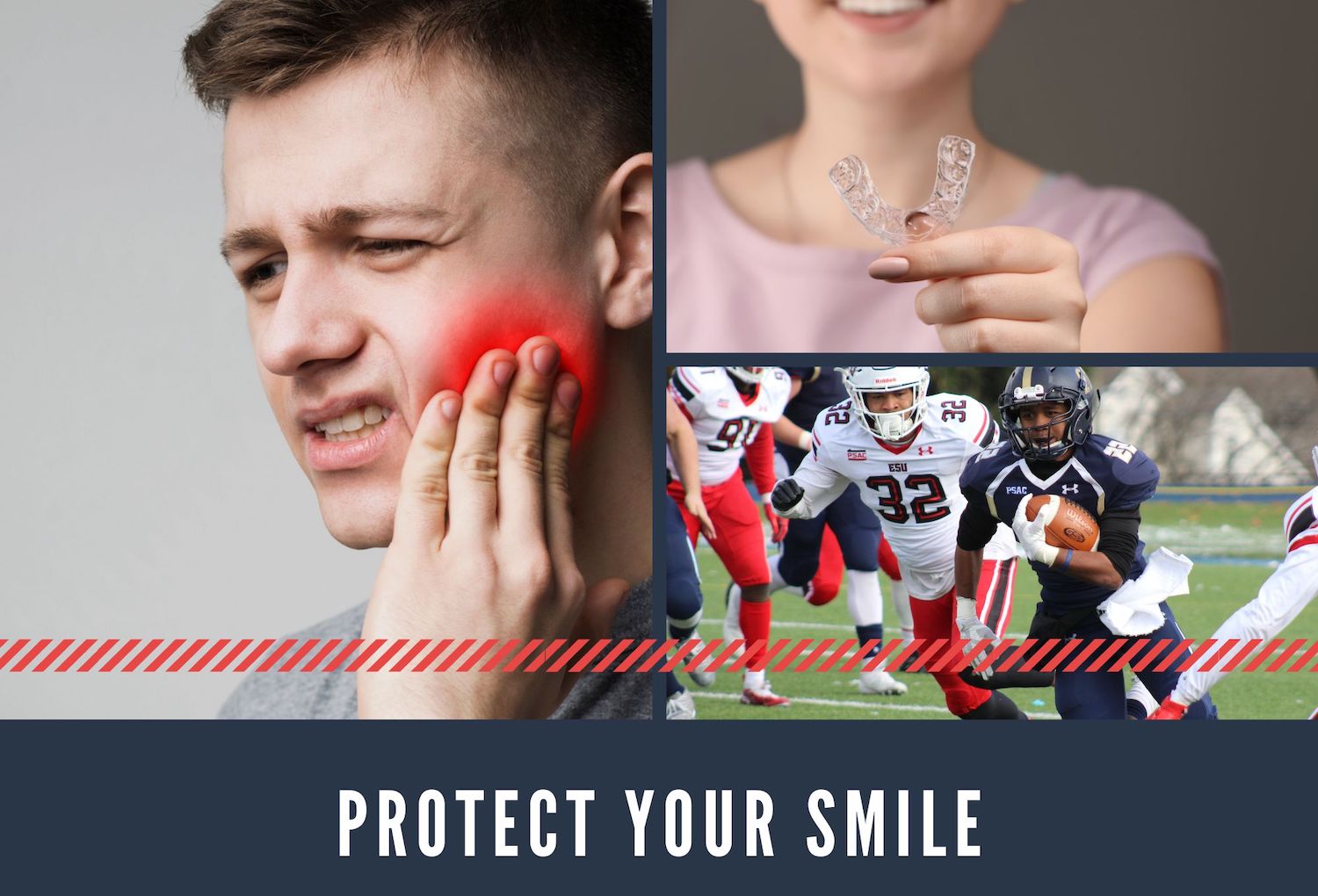 mouthguards image